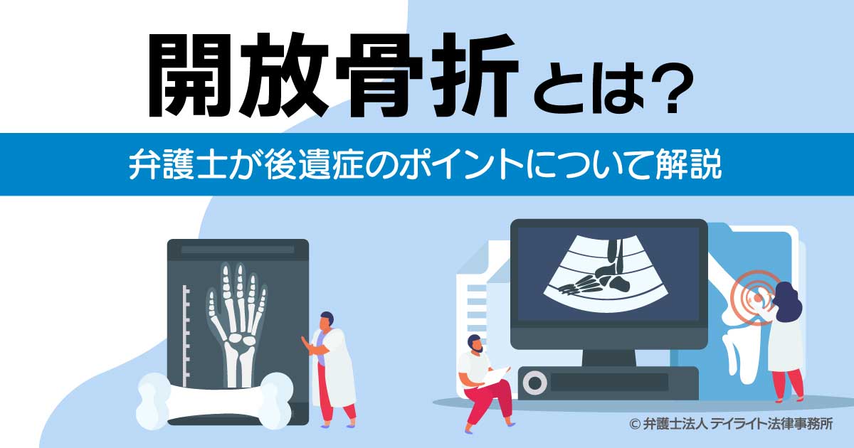 開放骨折とは？｜対処法や後遺症のポイント | 交通事故の相談はデイライト法律事務所