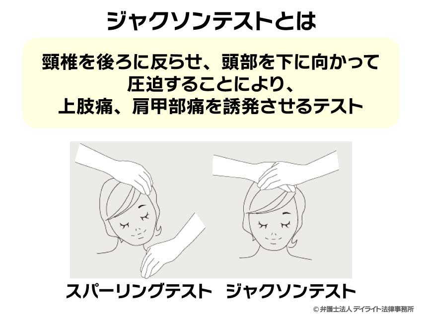 ジャクソンテストとは？